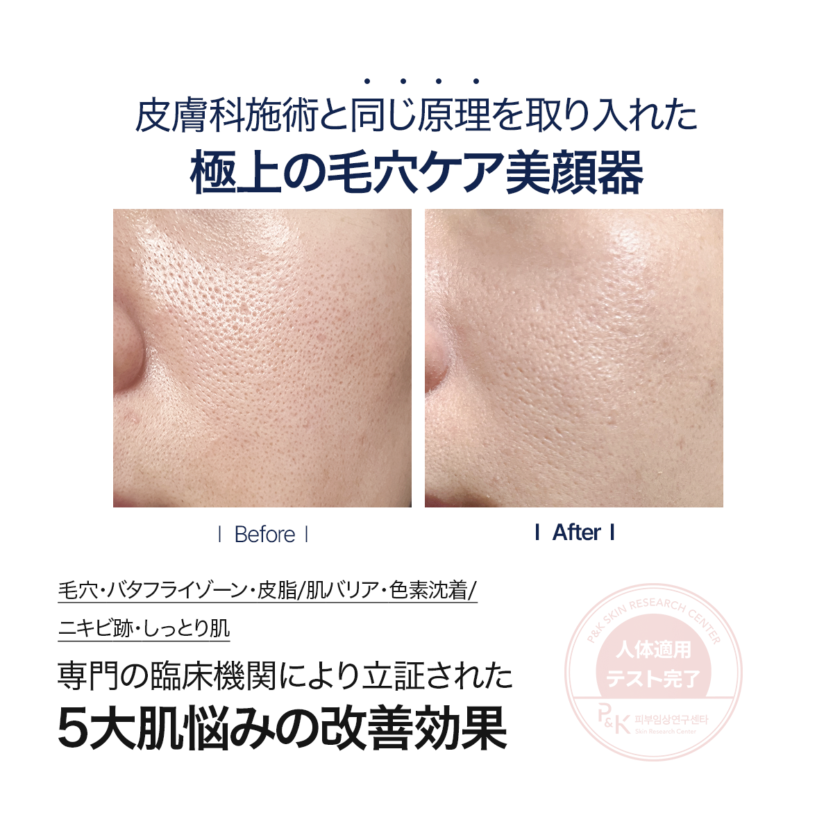 公式】 ペンタショット – CELORA.BY JP 公式】 ペンタショット – CELORA.BY JP